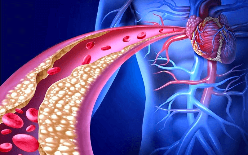 Breaking Down Hypercholesterolemia: Understanding Its Causes, Risks, and Management